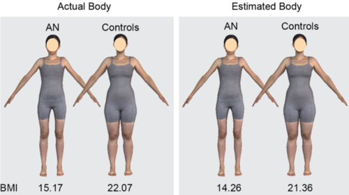 Anorexia And Body Shape Perceiving Systems Max Planck